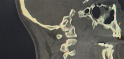 1679273330853068565.png 图片1.png