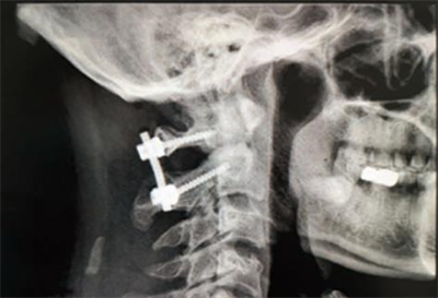 1679273422269088422.png 图片6.png