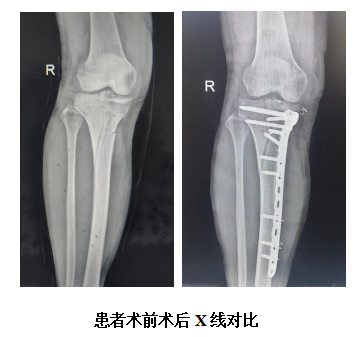 1686303235106068782.png QQ截图20230609173207.png