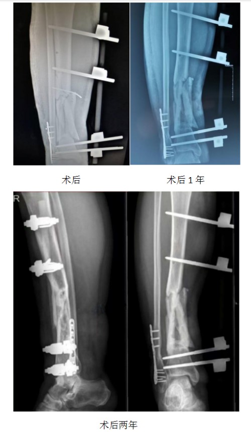 1772238623158055892.jpg 2.jpg